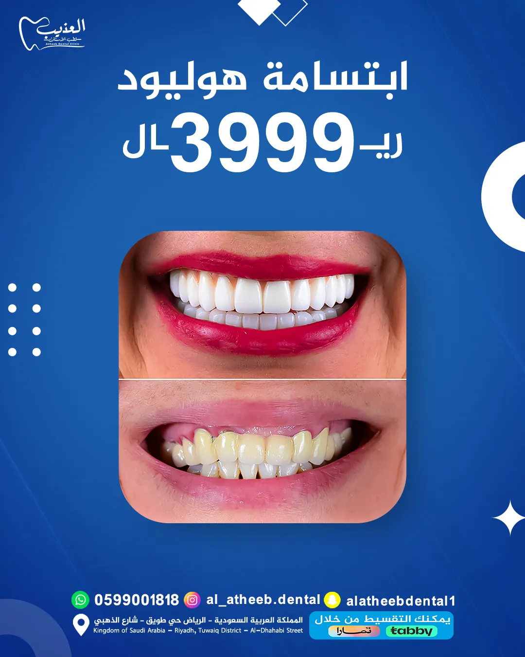 تصاميم السوشيال ميديا لعيادة عذيب لطب الأسنان - صورة 3