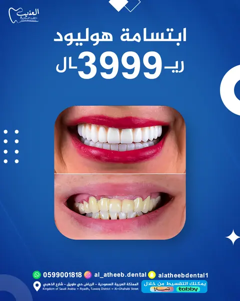 صورة 3