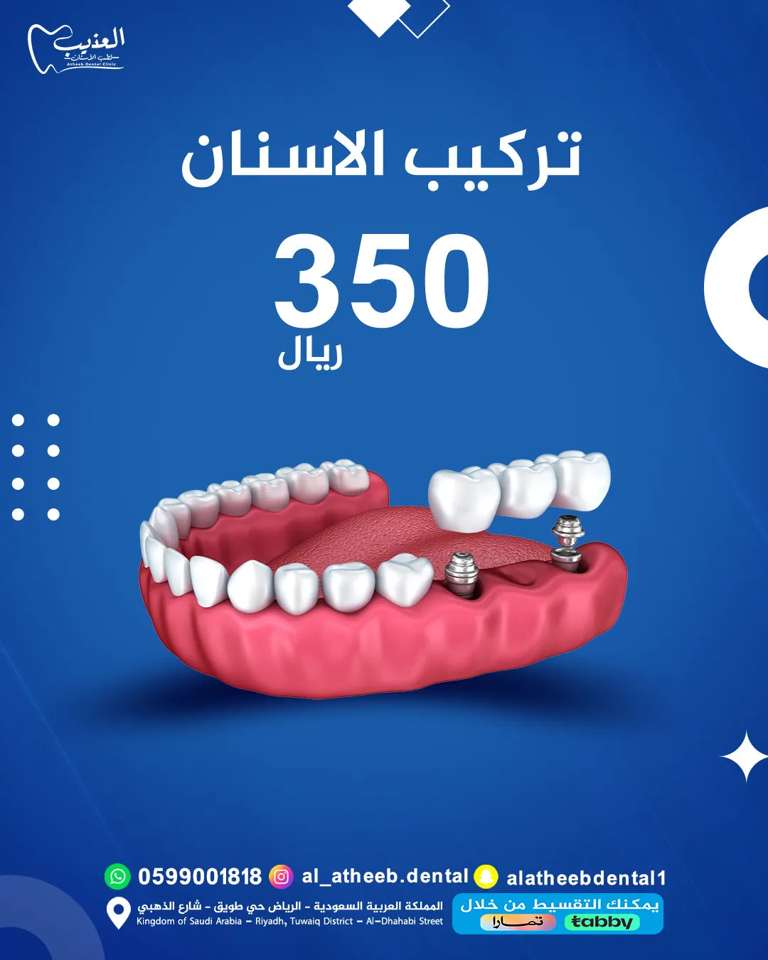 تصاميم السوشيال ميديا لعيادة عذيب لطب الأسنان - صورة 5